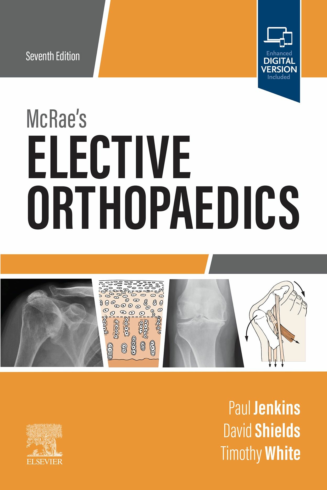 McRae's Elective Orthopaedics E-Book