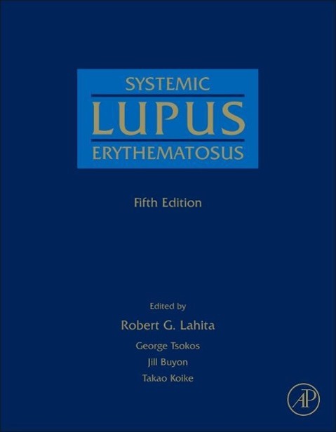 Systemic Lupus Erythematosus