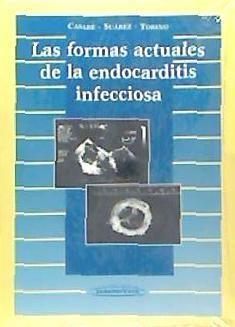 Las formas actuales de la endocarditis infecciosa