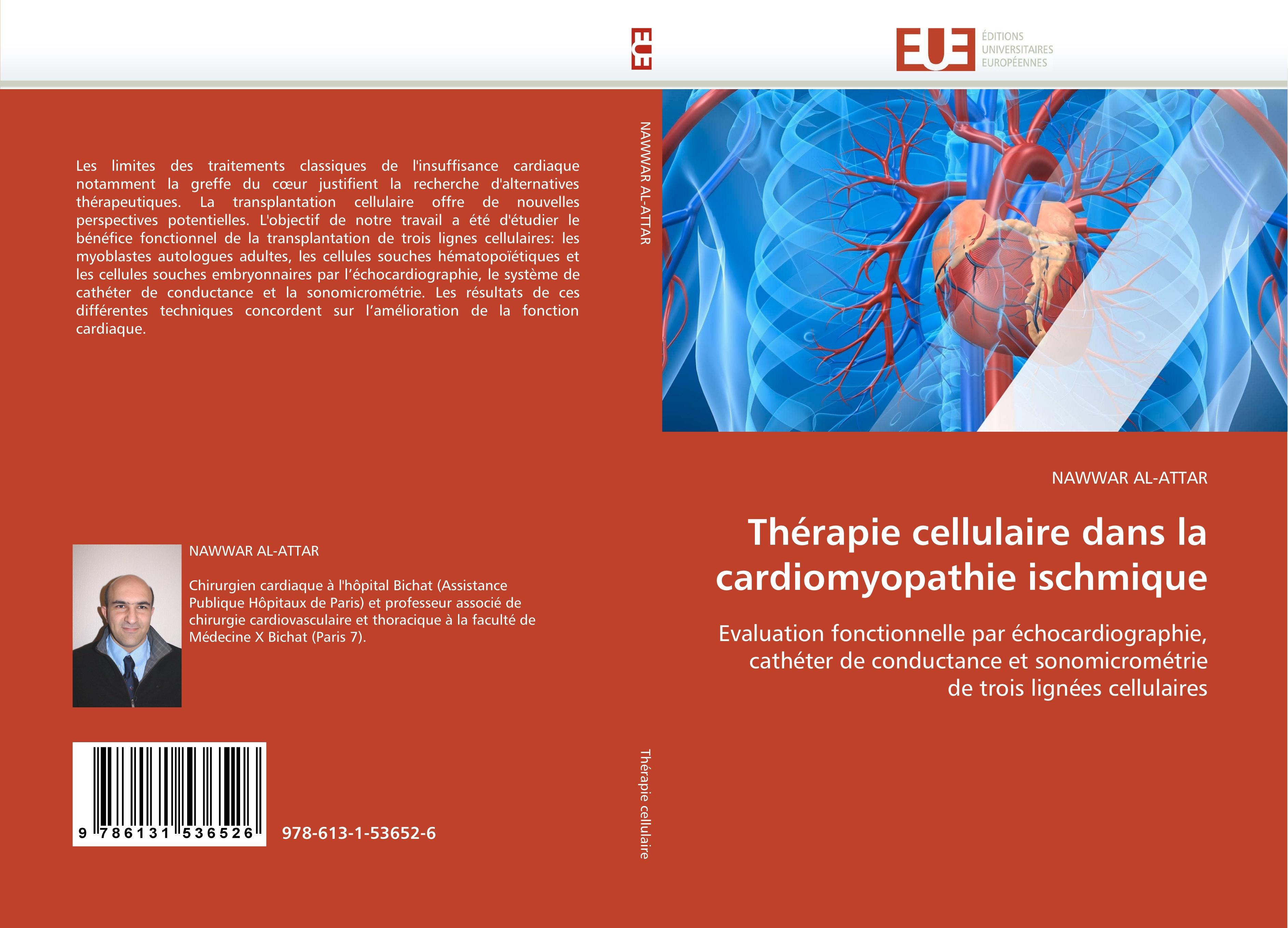 Thérapie cellulaire dans la cardiomyopathie ischmique