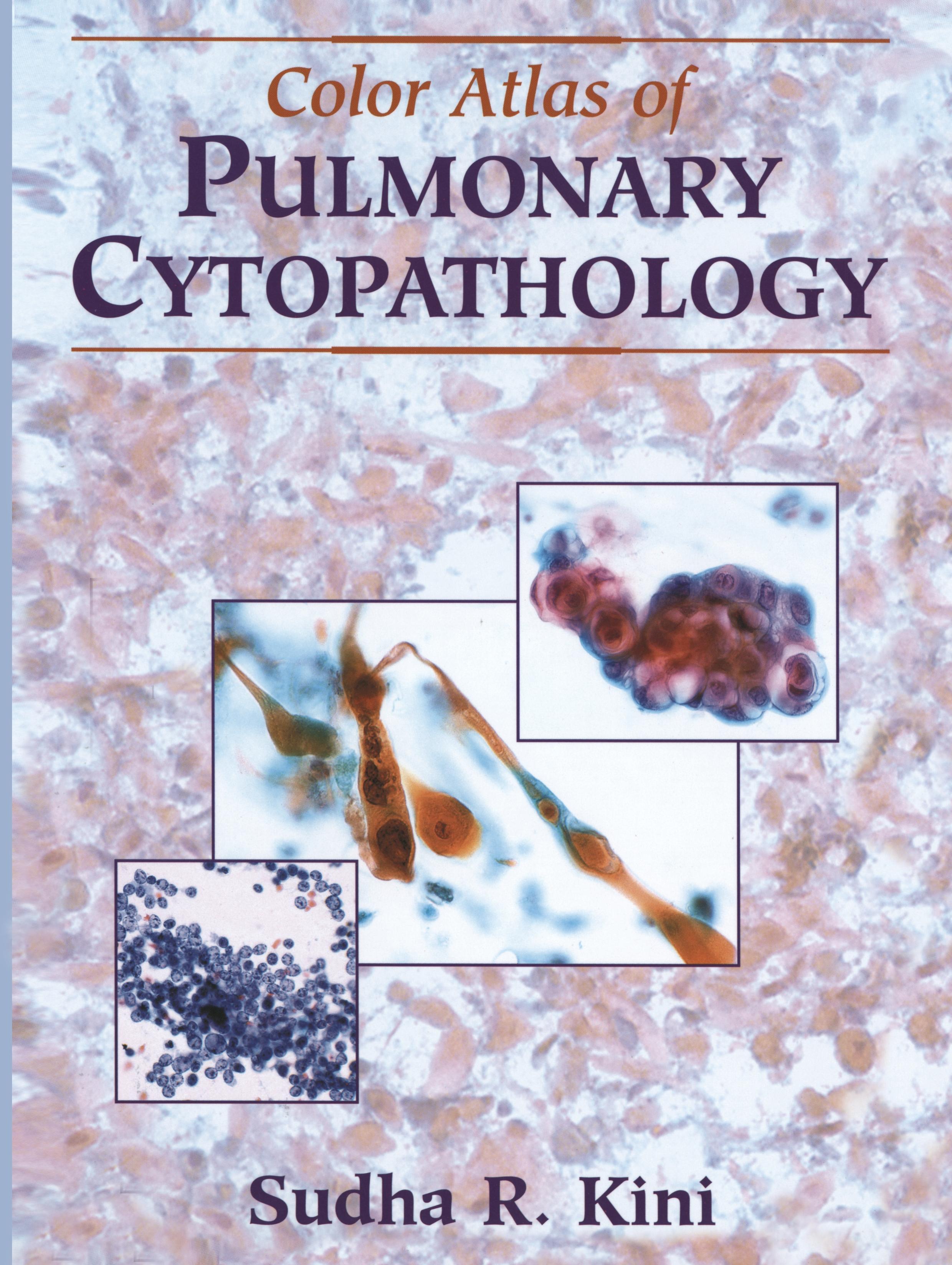 Color Atlas of Pulmonary Cytopathology