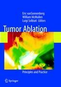 Tumor Ablation