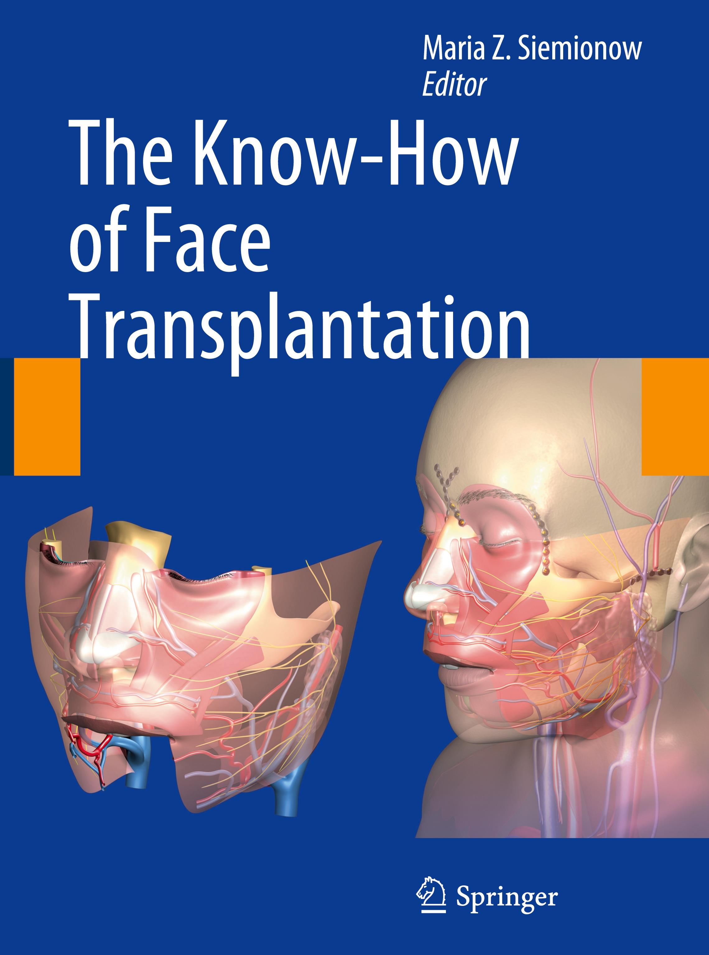 The Know-How of Face Transplantation