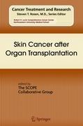 Skin Cancer after Organ Transplantation