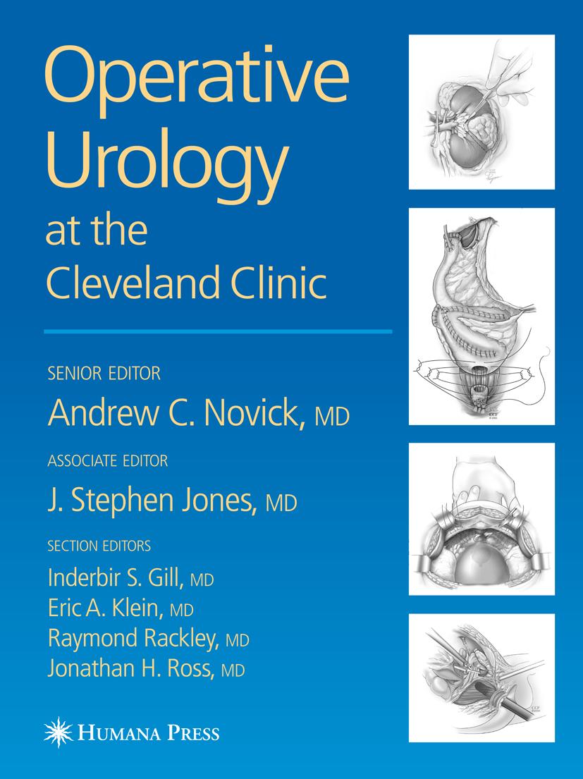 Operative Urology