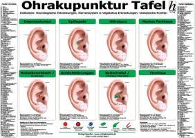 Ohrakupunktur Tafel - Indikation: Neurologische Erkrankungen, Nervensystem & Vegetative Erkrankungen