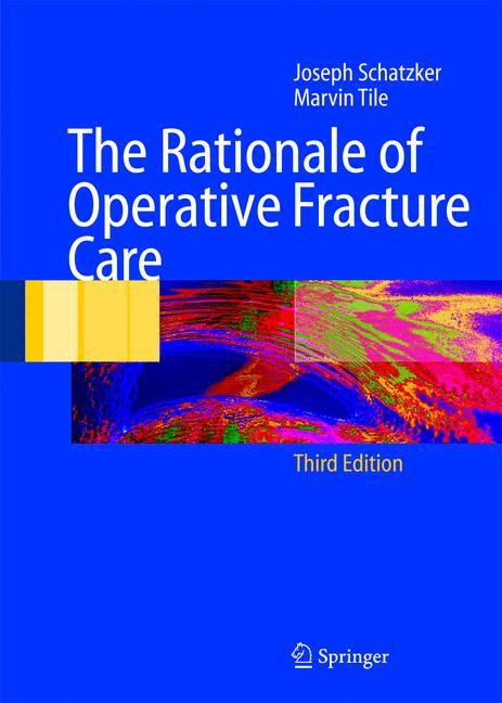 The Rationale of Operative Fracture Care