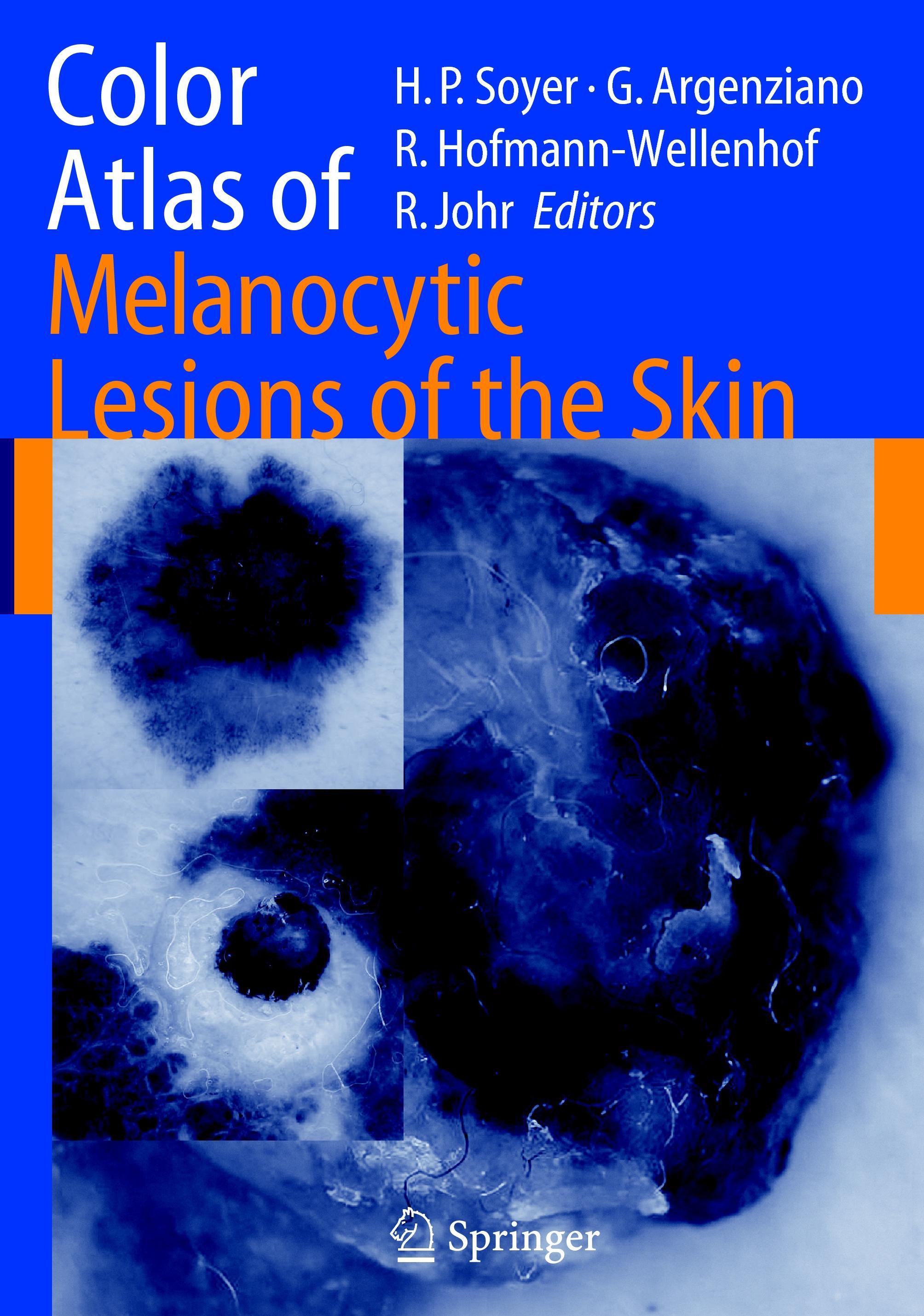 Color Atlas of Melanocytic Lesions of the Skin