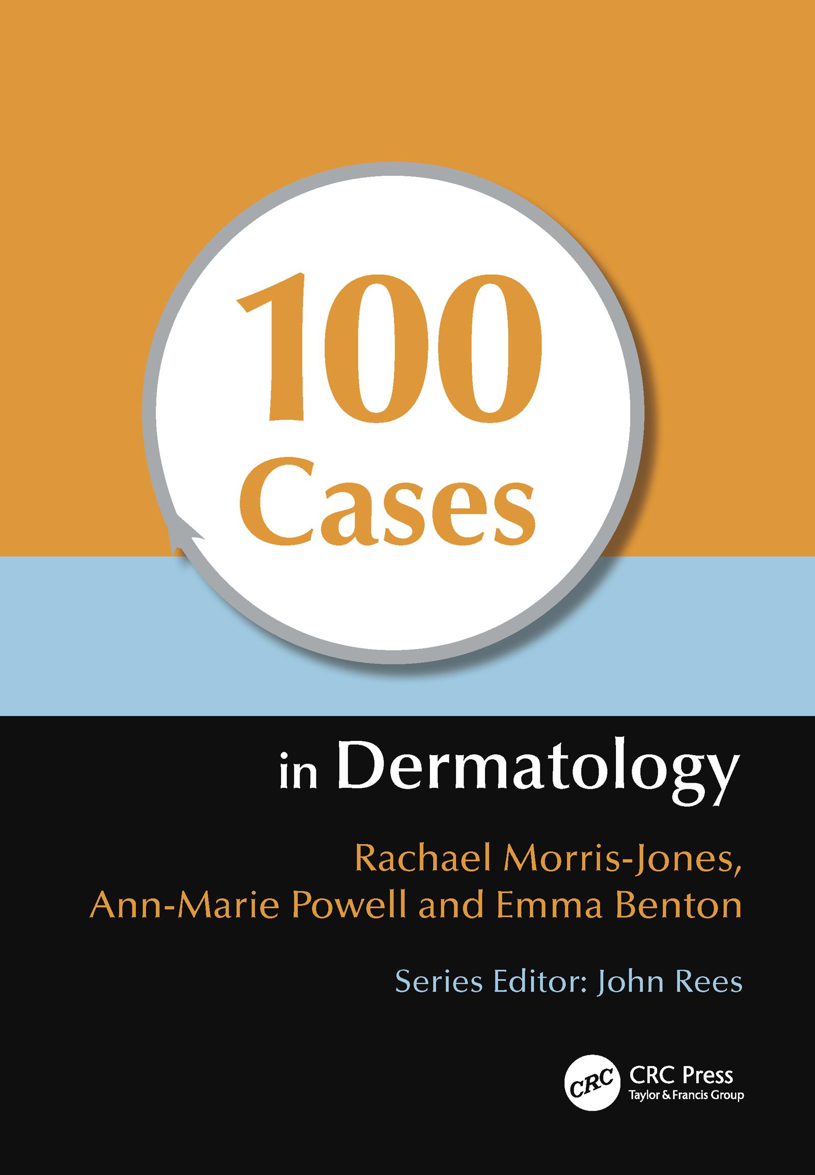 100 Cases in Dermatology