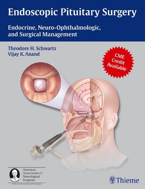 Endoscopic Pituitary Surgery