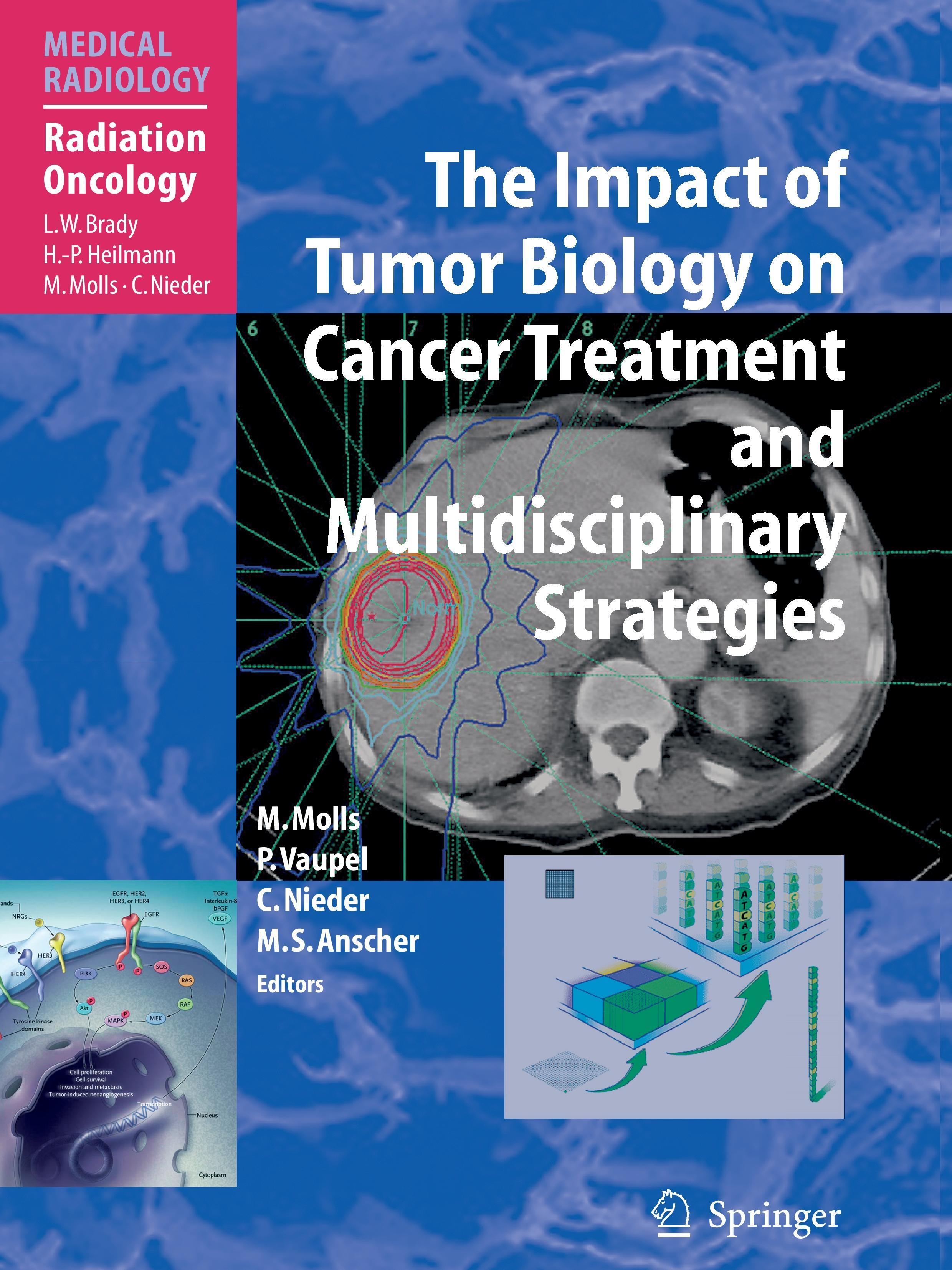 The Impact of Tumor Biology on Cancer Treatment and Multidisciplinary Strategies