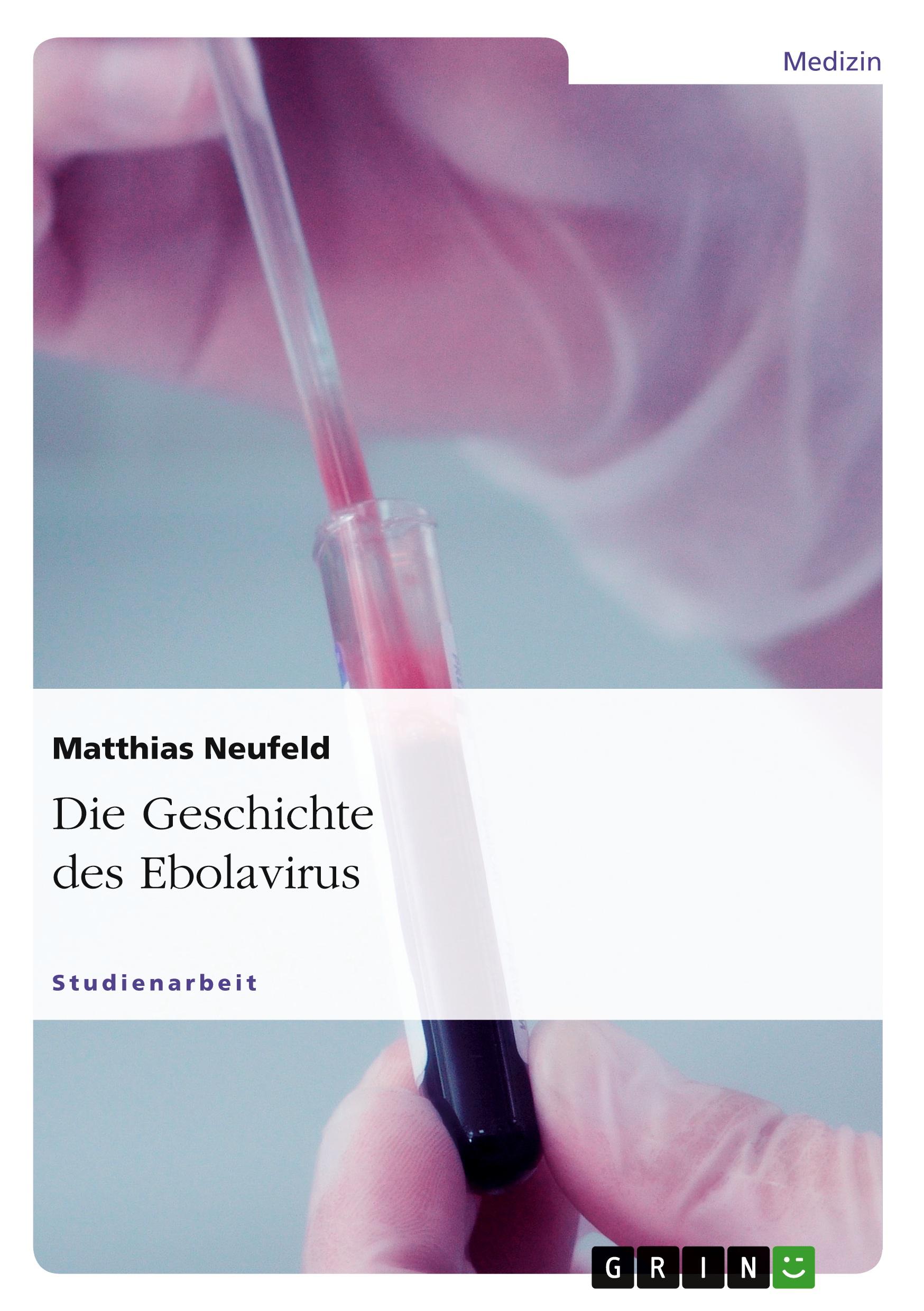 Die Geschichte des Ebolavirus