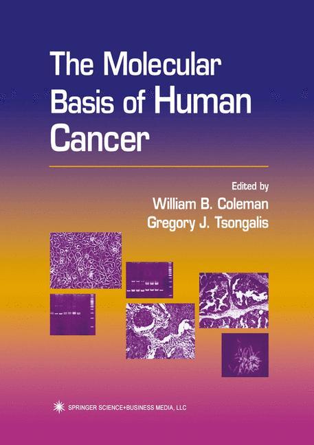 The Molecular Basis of Human Cancer