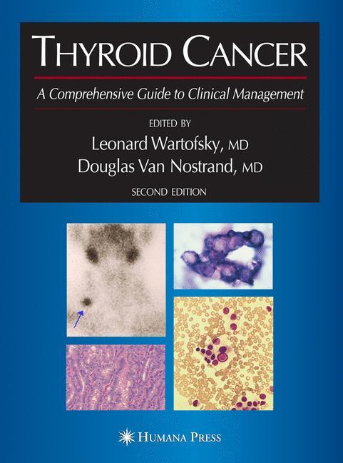 Thyroid Cancer