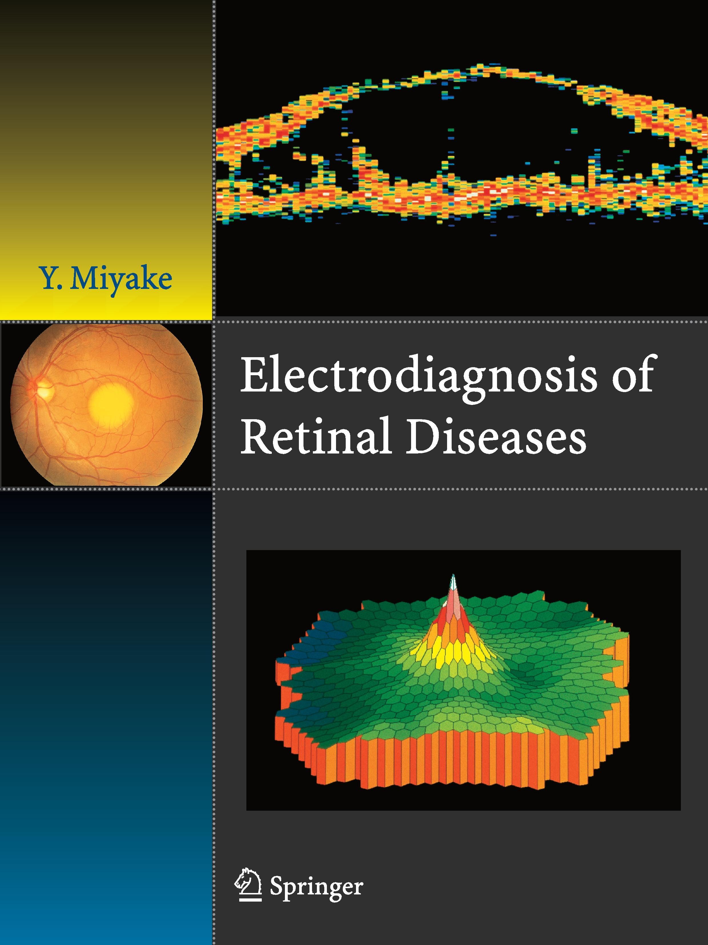 Electrodiagnosis of Retinal Disease