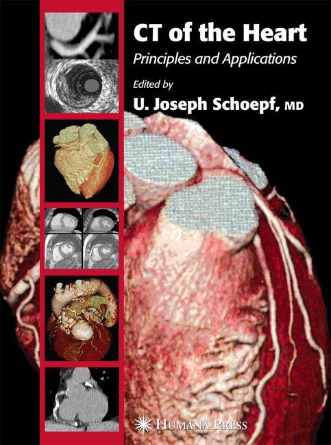 CT of the Heart