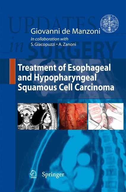 Treatment of Esophageal and Hypopharingeal Squamous Cell Carcinoma