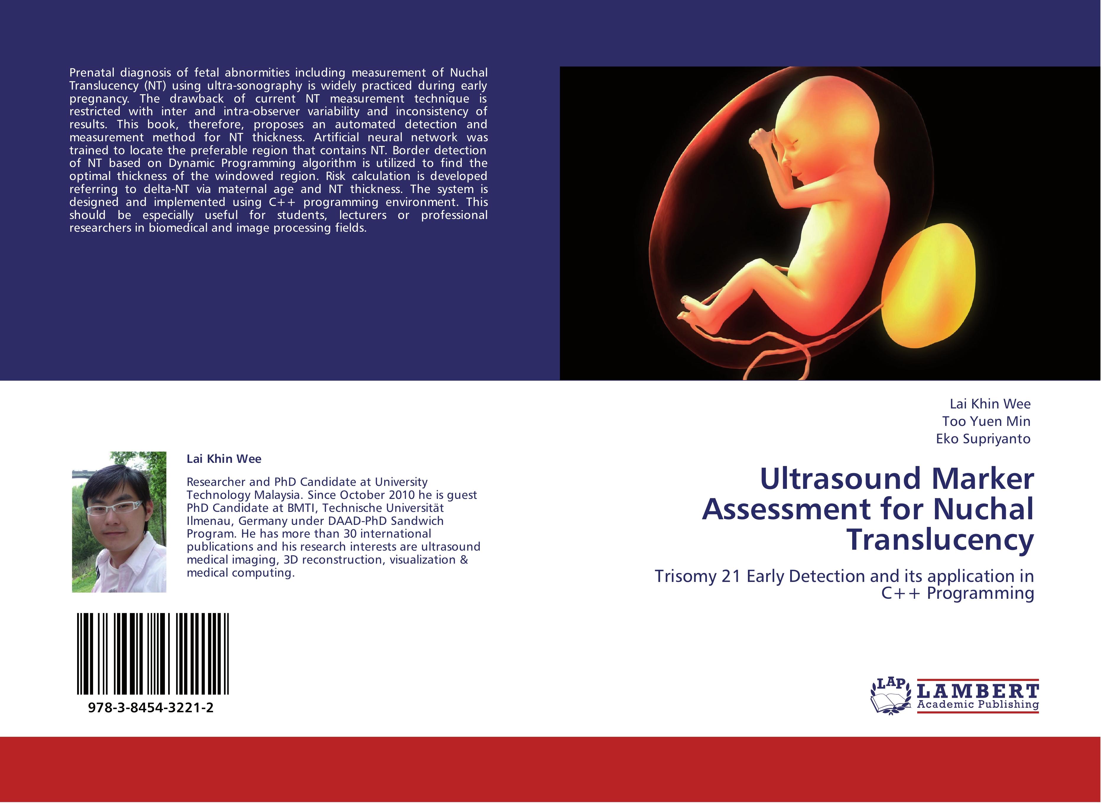 Ultrasound Marker Assessment  for Nuchal Translucency