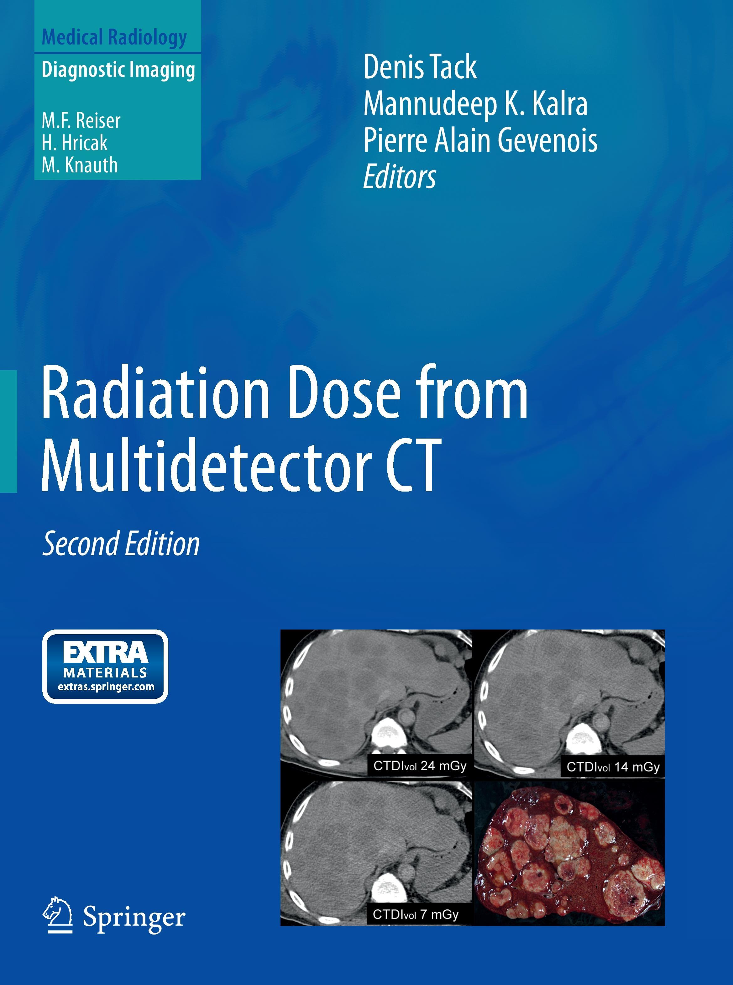 Radiation Dose from Multidetector CT