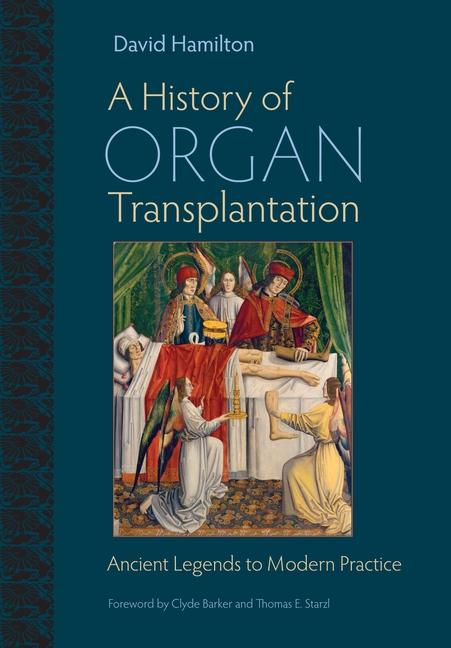 A History of Organ Transplantation