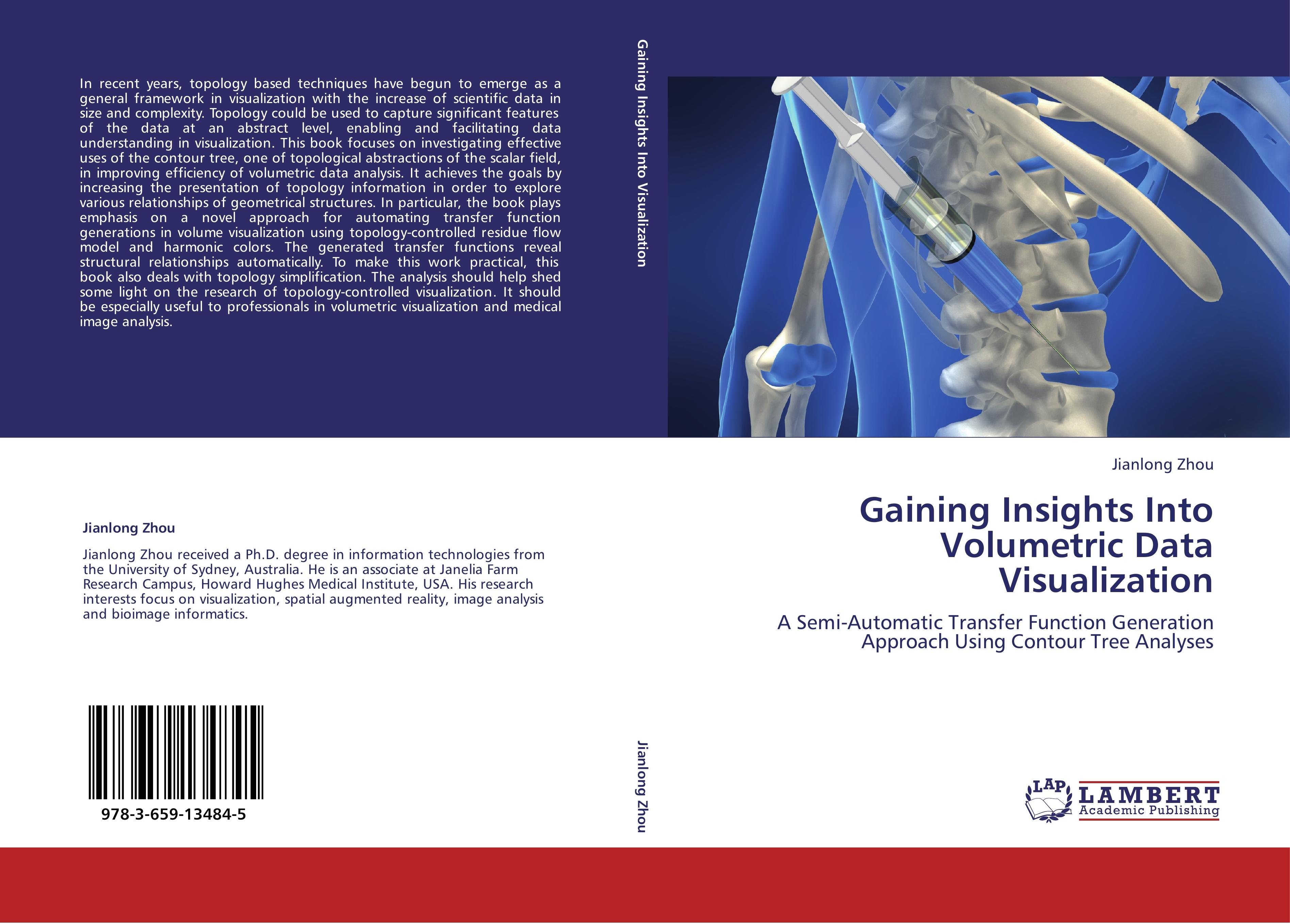 Gaining Insights Into Volumetric Data Visualization