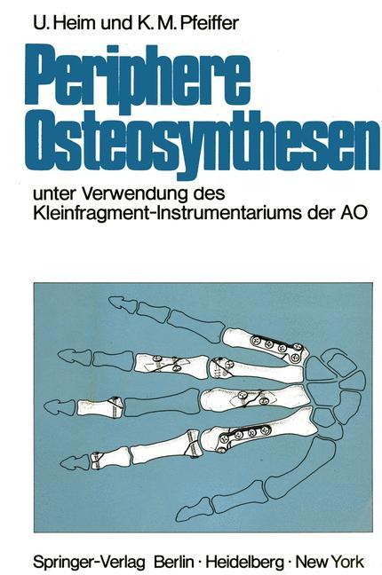 Periphere Osteosynthesen