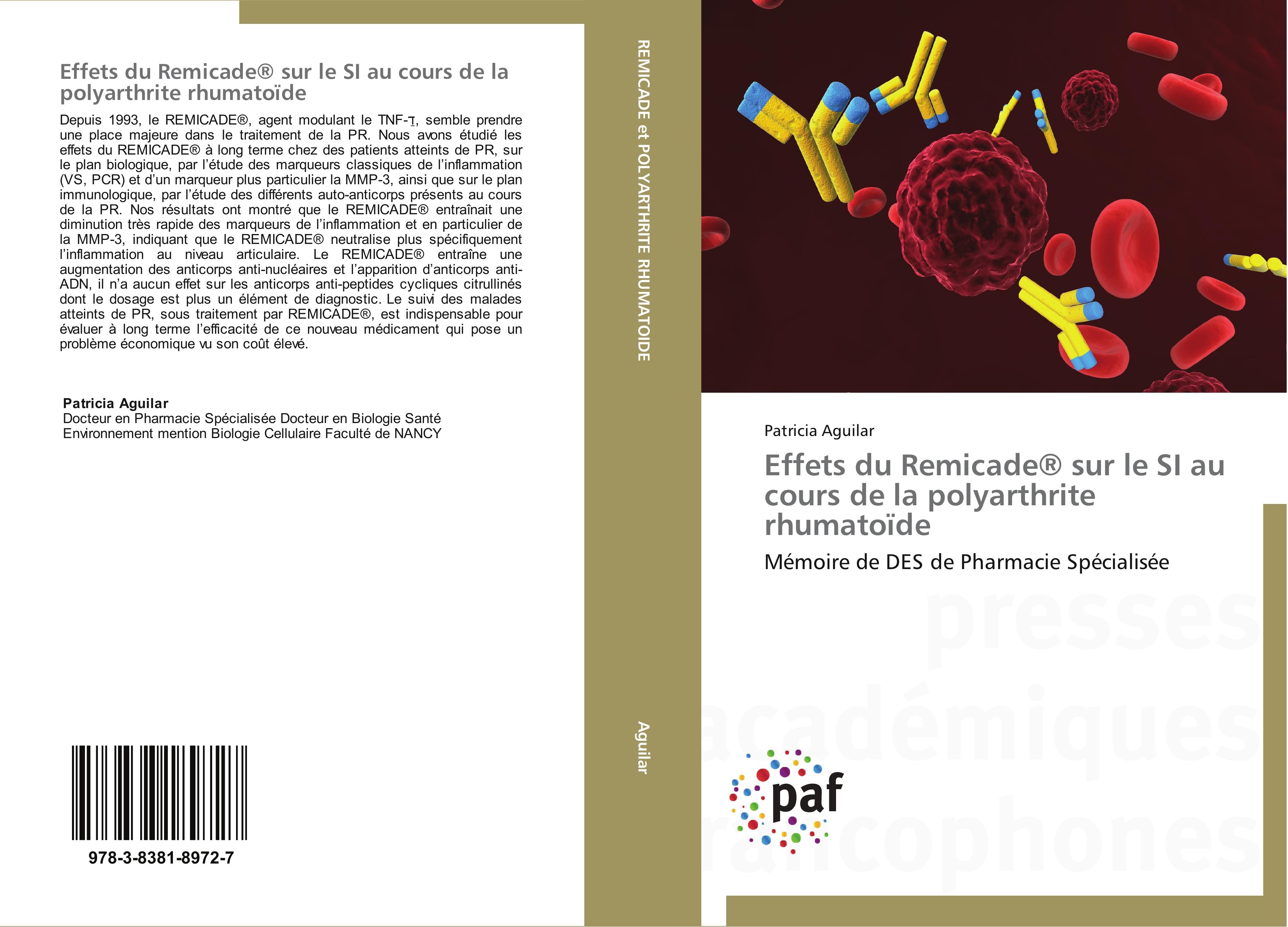 Effets du Remicade® sur le SI au cours de la polyarthrite rhumatoïde