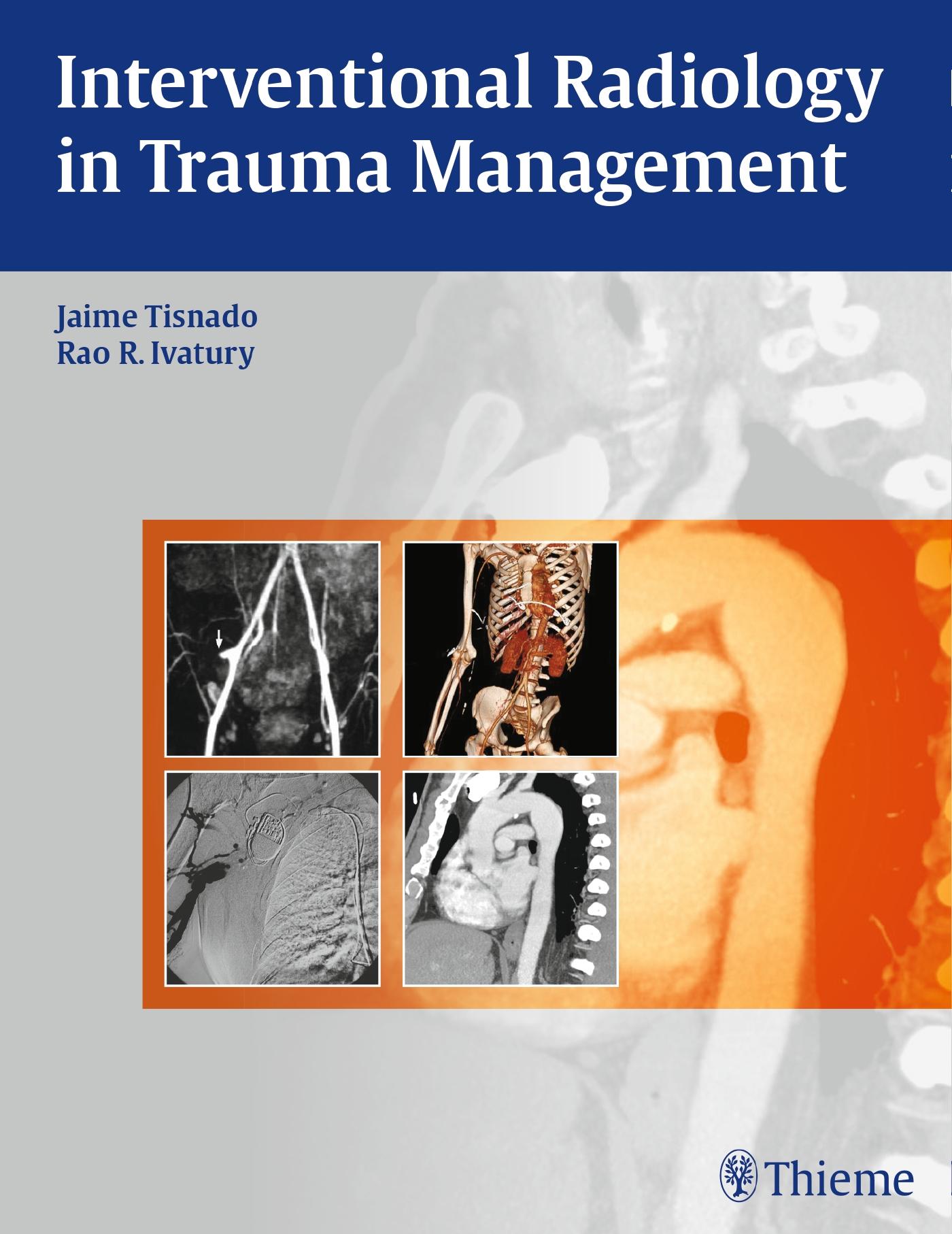 Interventional Radiology in Trauma