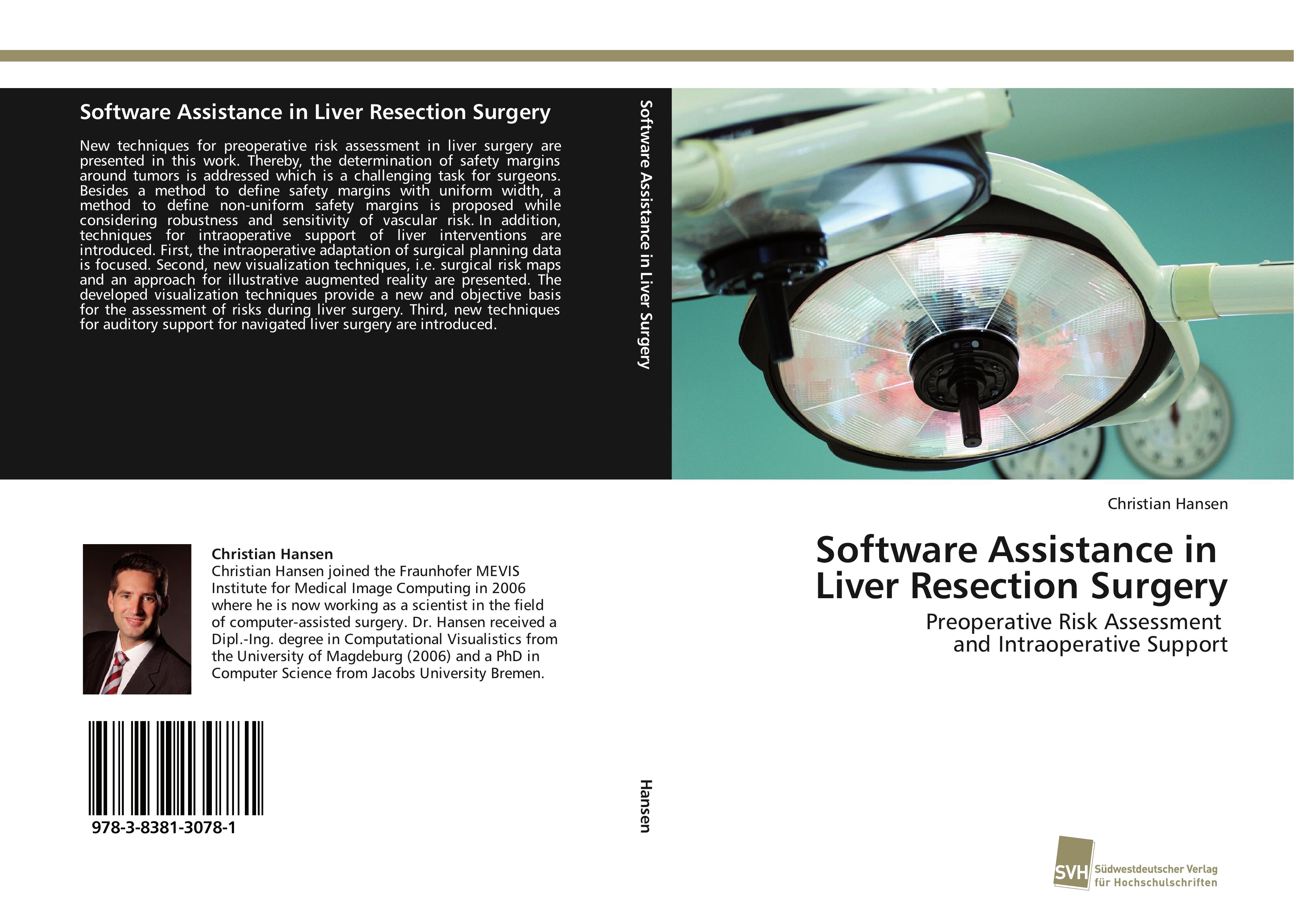 Software Assistance in Liver Resection Surgery