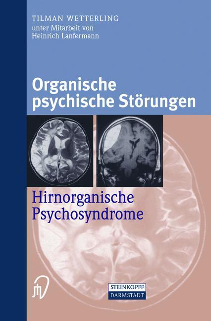 Organische psychische Störungen