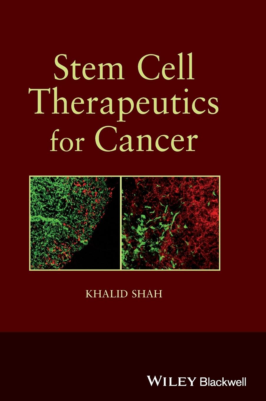 Stem Cell Therapeutics for Can