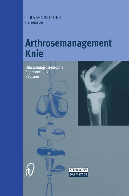 Arthrosemanagement Knie