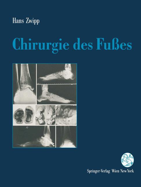 Chirurgie des Fußes