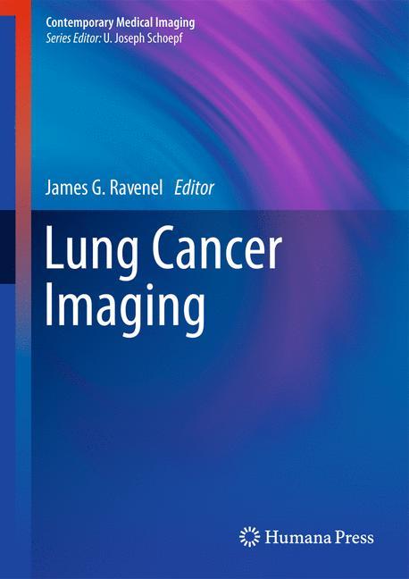 Lung Cancer Imaging