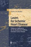 Lasers for Ischemic Heart Disease