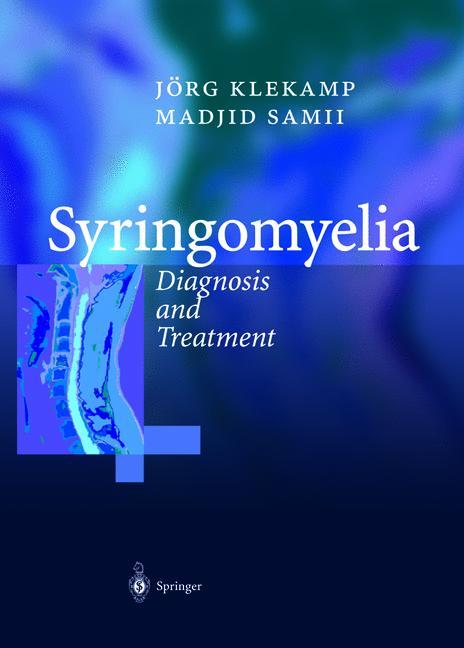 Syringomyelia