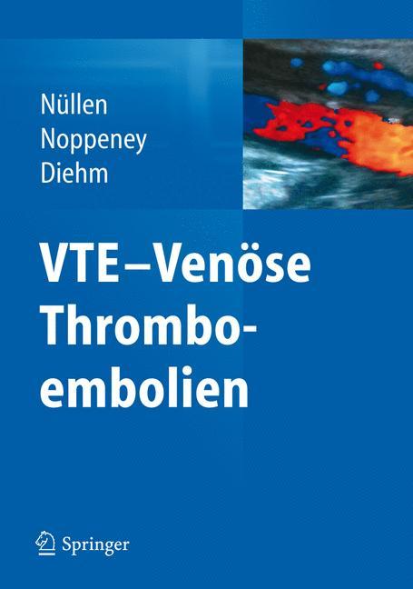 VTE - Venöse Thromboembolien