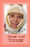 Facelift - na und?