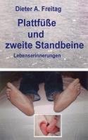 Plattfüße und zweite Standbeine