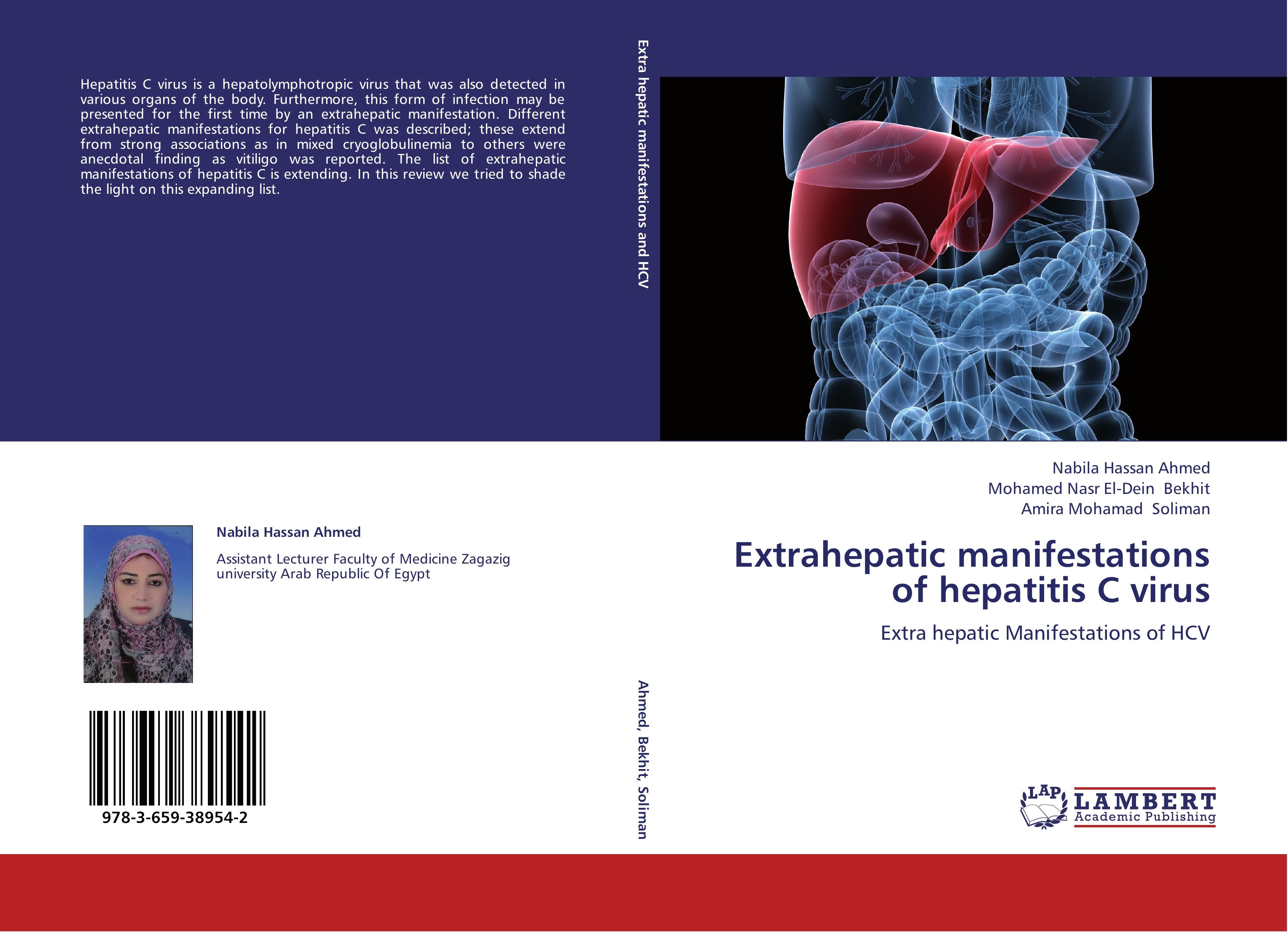 Extrahepatic manifestations of hepatitis C virus