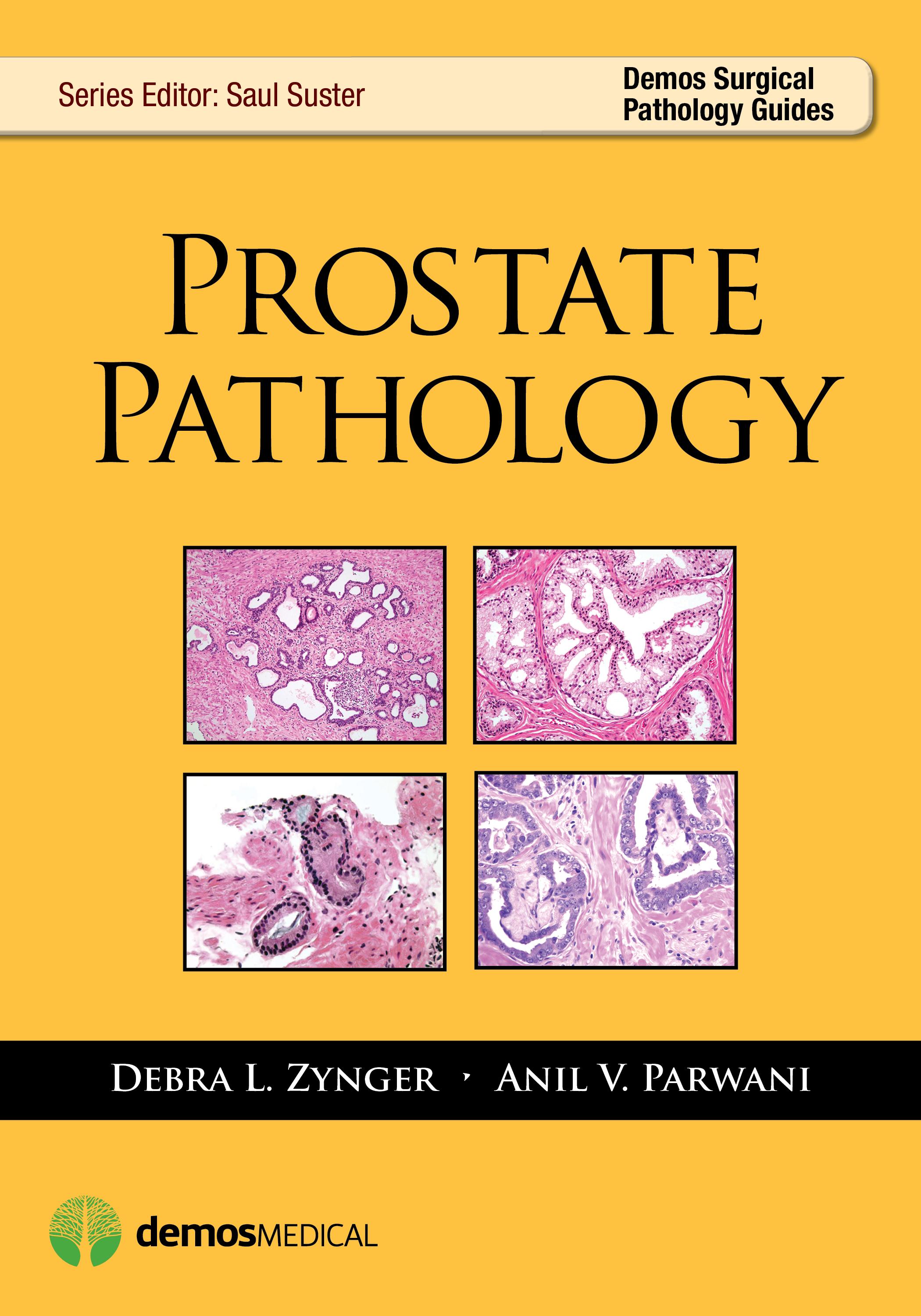 Prostate Pathology