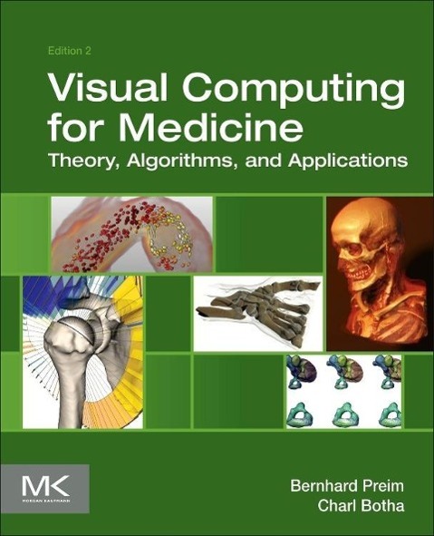 Visual Computing for Medicine