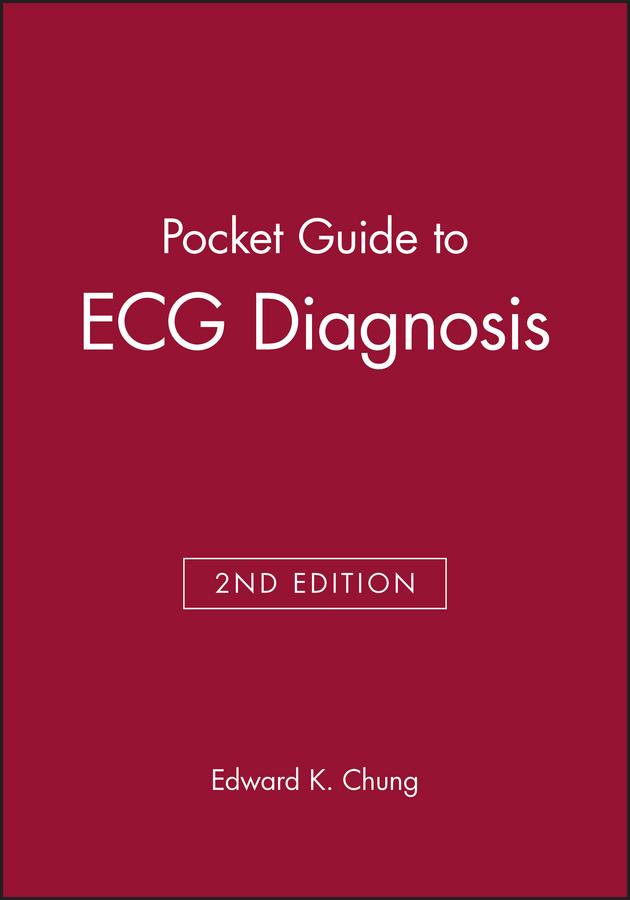 Pocket Guide to ECG Diagnosis