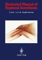 Illustrated Manual of Regional Anesthesia