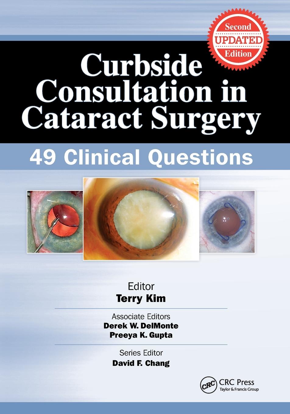 Curbside Consultation in Cataract Surgery