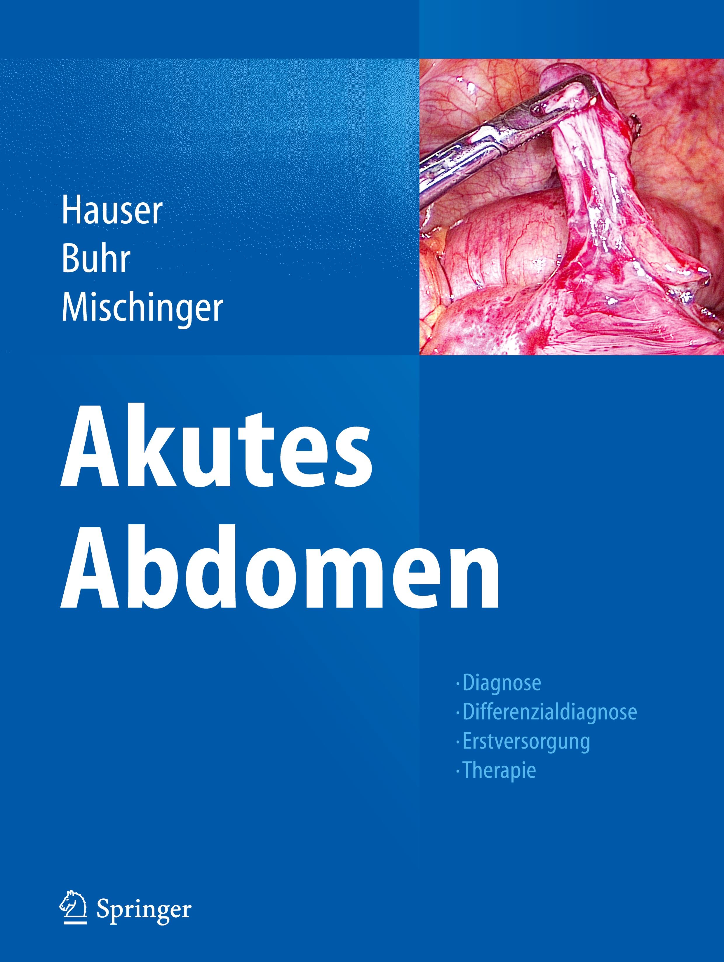 Akutes Abdomen