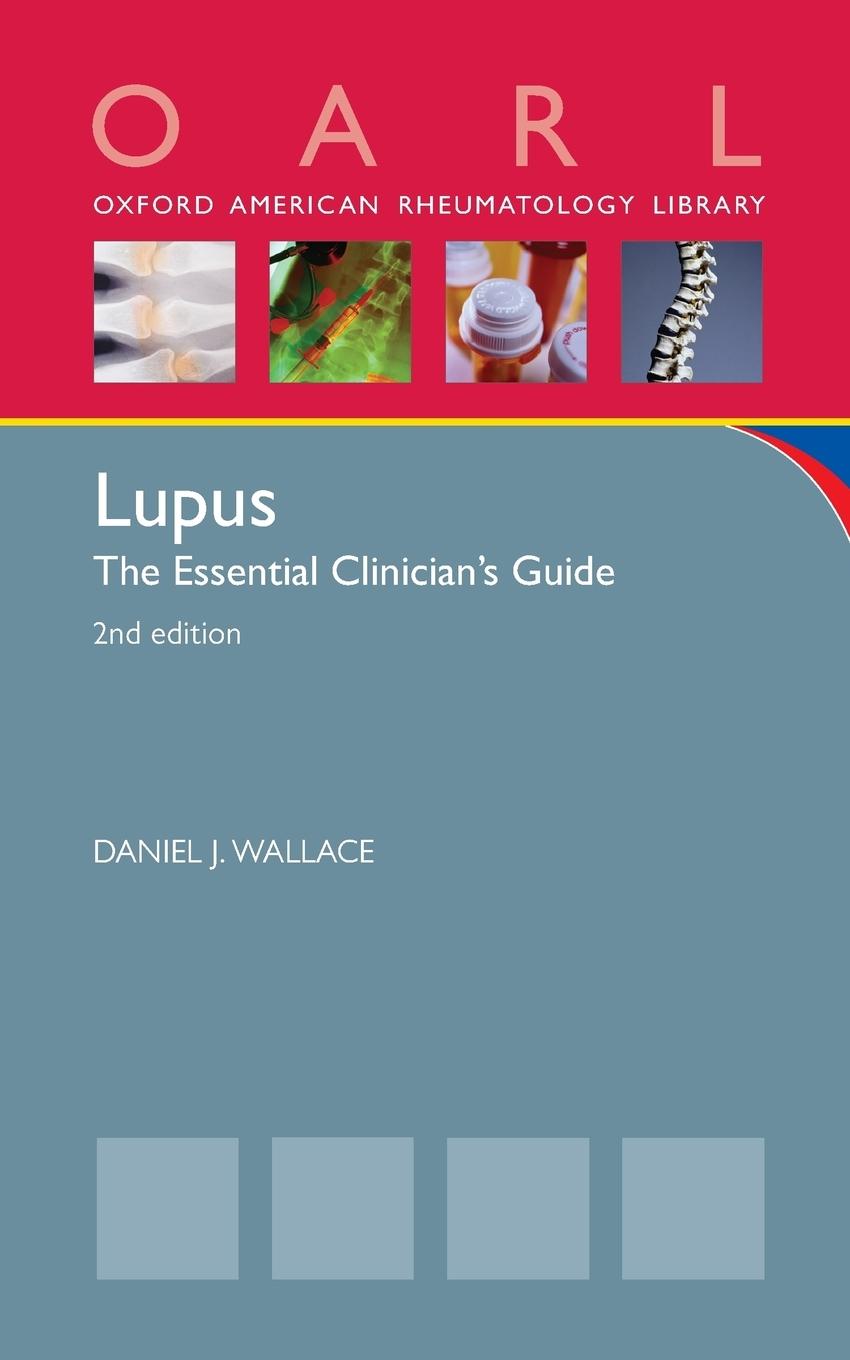 Lupus