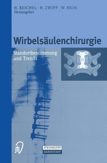 Wirbelsäulenchirurgie