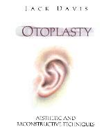 Otoplasty