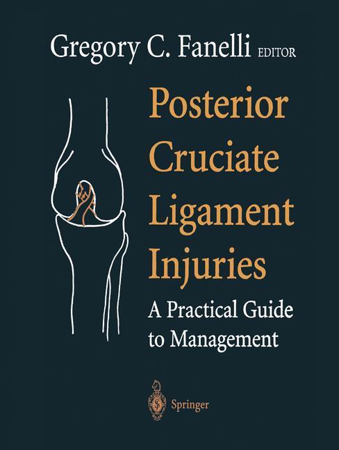 Posterior Cruciate Ligament Injuries